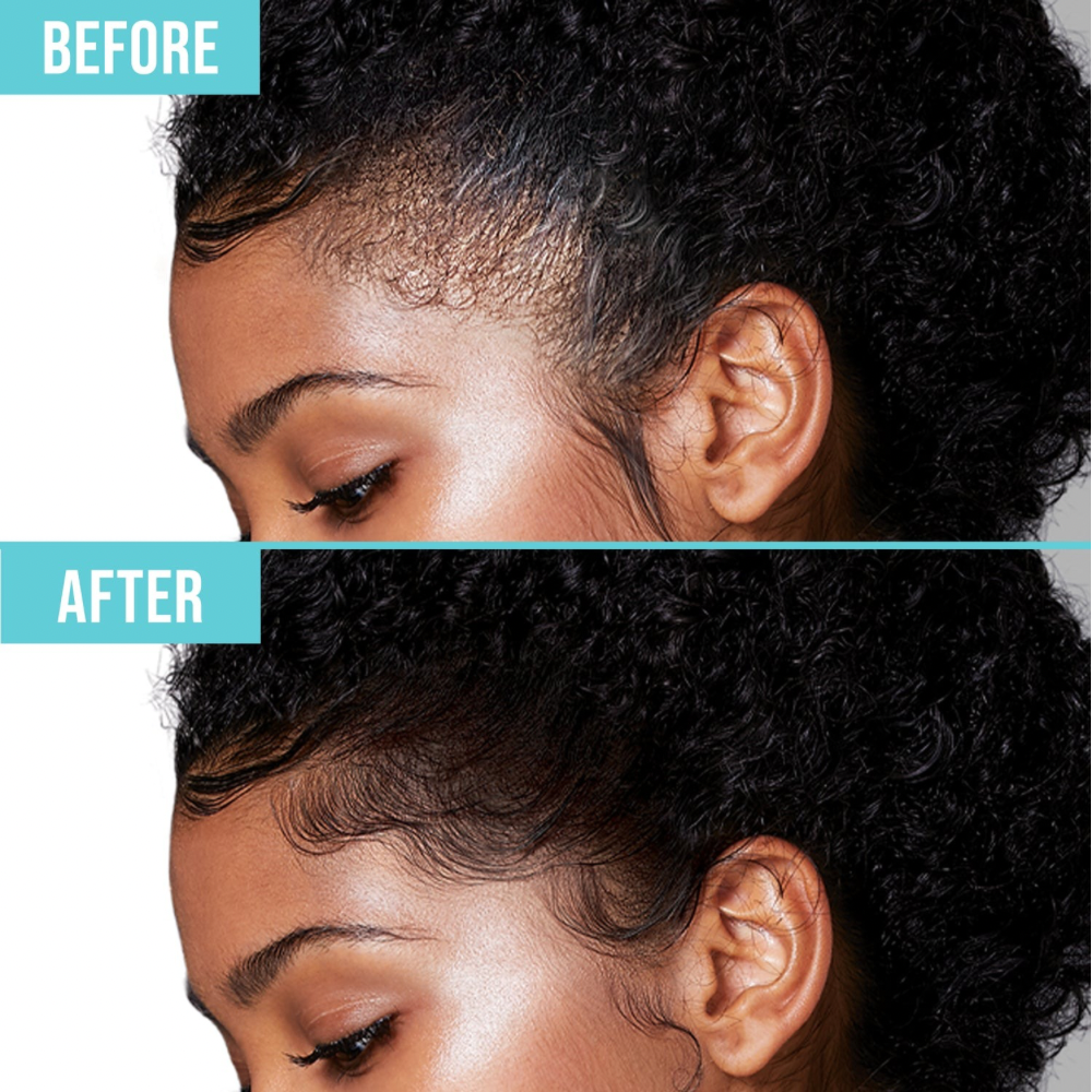 Cepillo para Baby Hair 4 en 1
