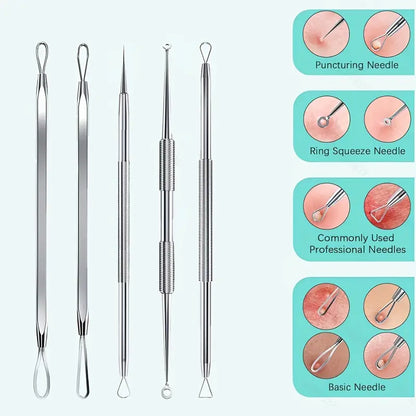 Kit Extractor de Puntos Negros